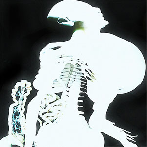 Álbum Entrañas de Arca