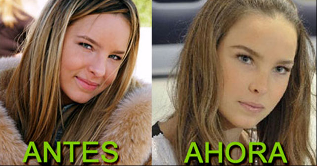 Nueva nariz de Belinda