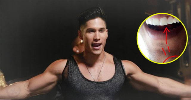 ¡Lamentable! Chino sufre un accidente en Ecuador (+FOTO)