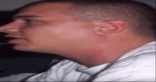 J Balvin con su cara rellena J Balvin con su cara rellena