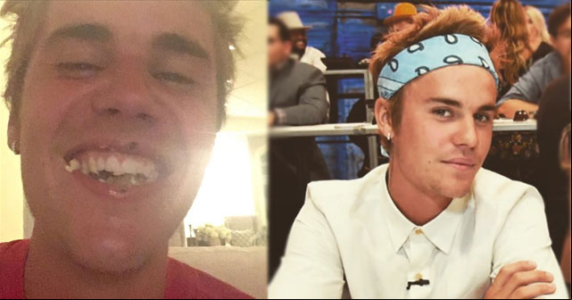 Justin Bieber fue criticado por publicar una foto desagradable
