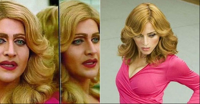 Extraña adicción: Joven gastó 175 mil dólares para parecerse a Madonna