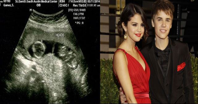 Rumor sobre el embarazo de Selena Gómez ¡ES FALSO!